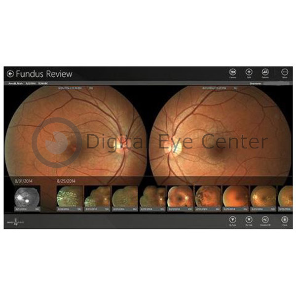 Click image for larger version. 

Name:	topcon-nw6s-fundus-2.JPG 
Views:	25 
Size:	80.5 KB 
ID:	12370