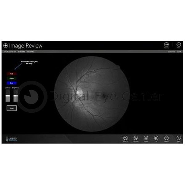 Click image for larger version. 

Name:	topcon-nw6s-fundus-3.JPG 
Views:	23 
Size:	50.8 KB 
ID:	12371